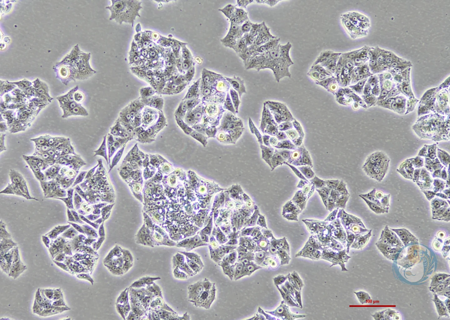 人肺腺癌细胞 NCI-H1395 2