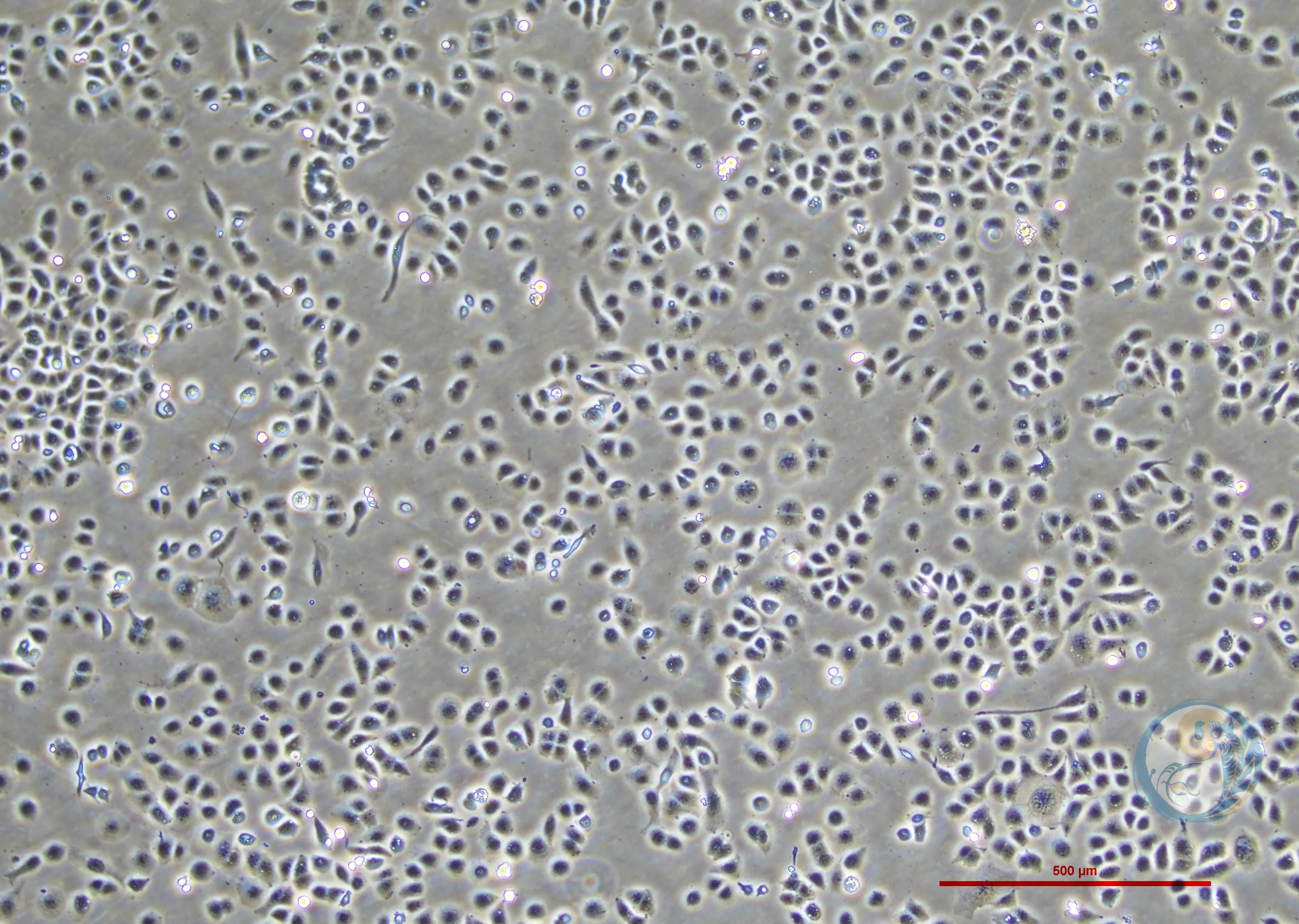 人子宫内膜腺癌细胞 HEC-1-A 2