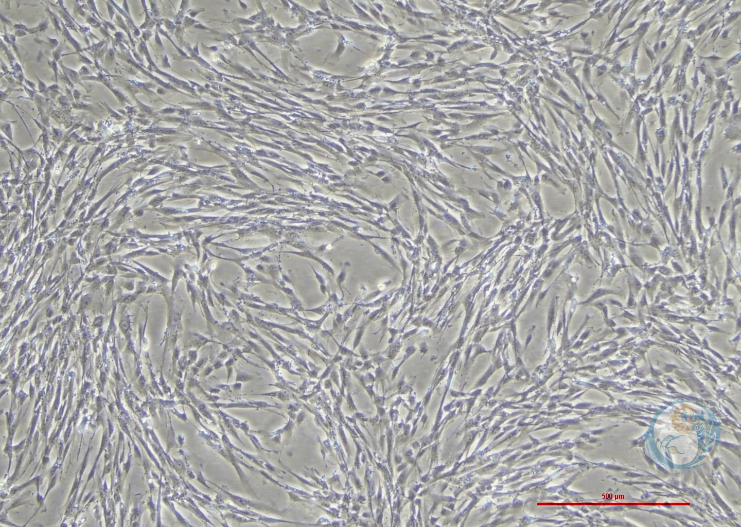 ihESCs 人子宫内膜异位基质细胞永生化 2