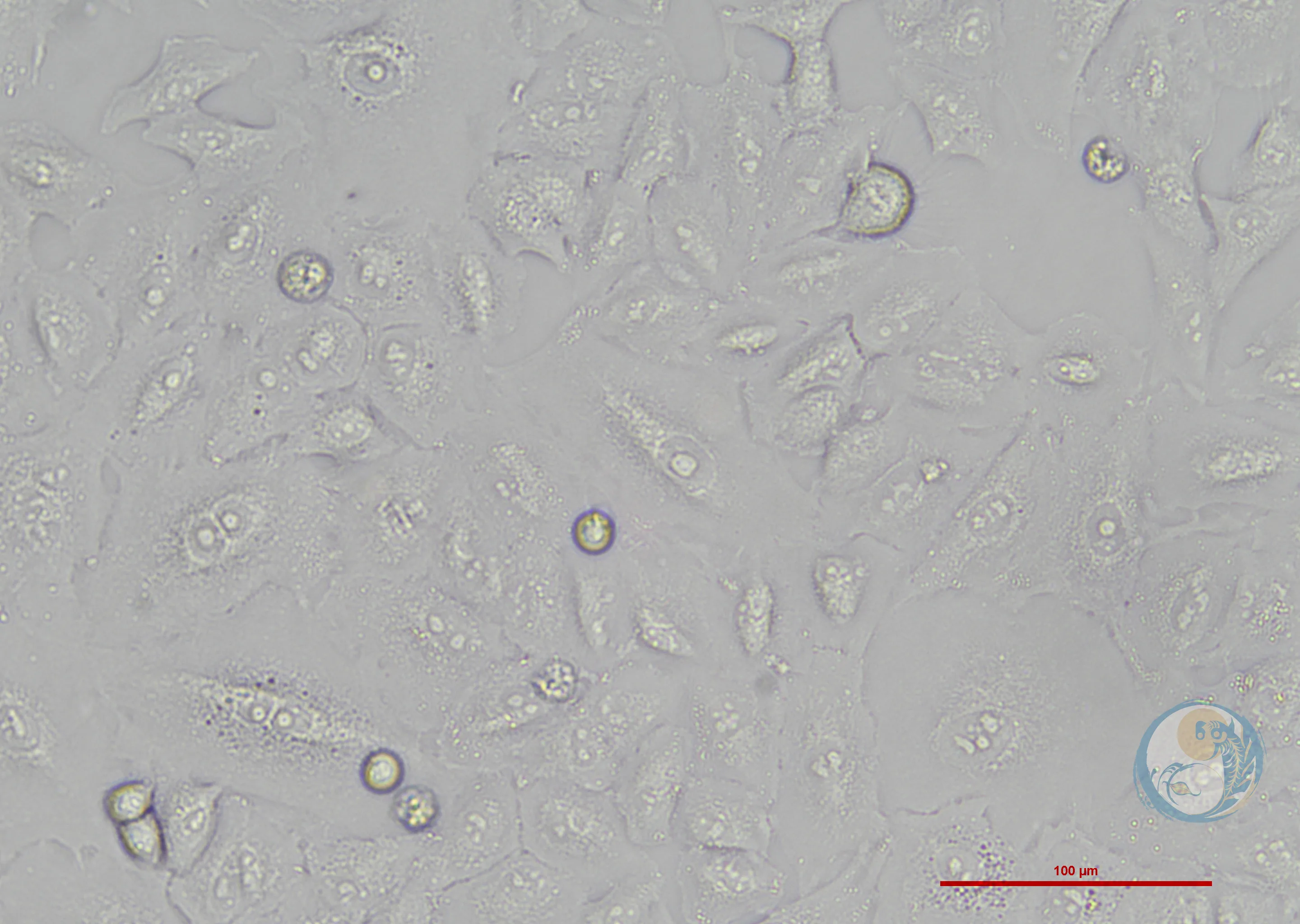 人肺腺癌顺铂耐药株 A549/DDP