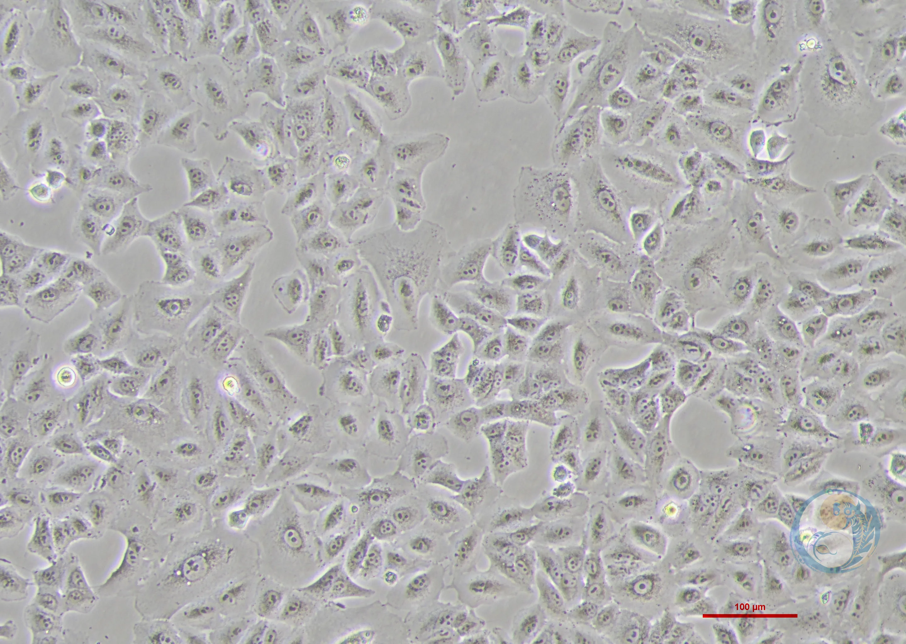 人肺腺癌顺铂耐药株 A549/DDP 2