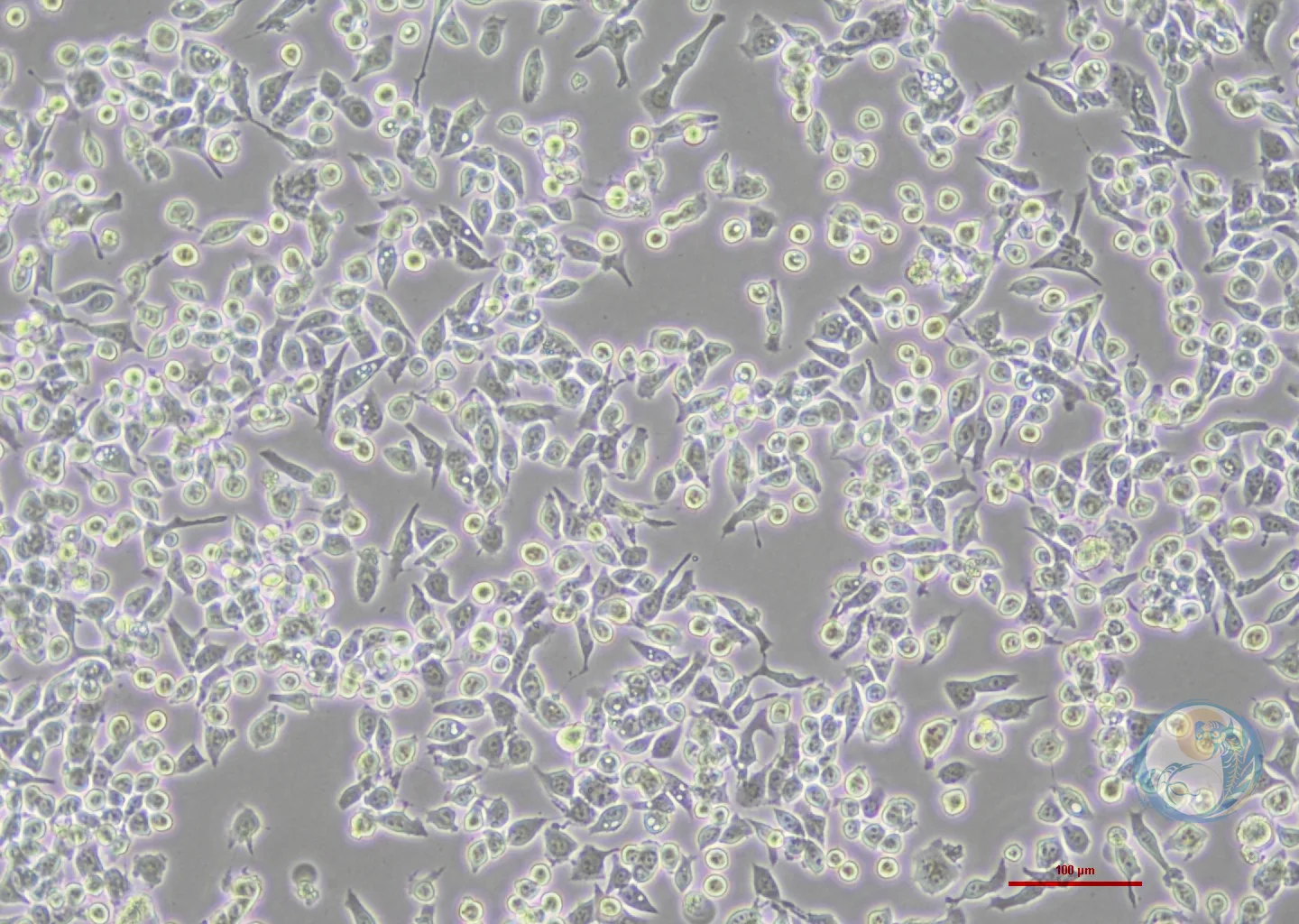 人胃癌细胞顺铂耐药株 MKN45-DDP