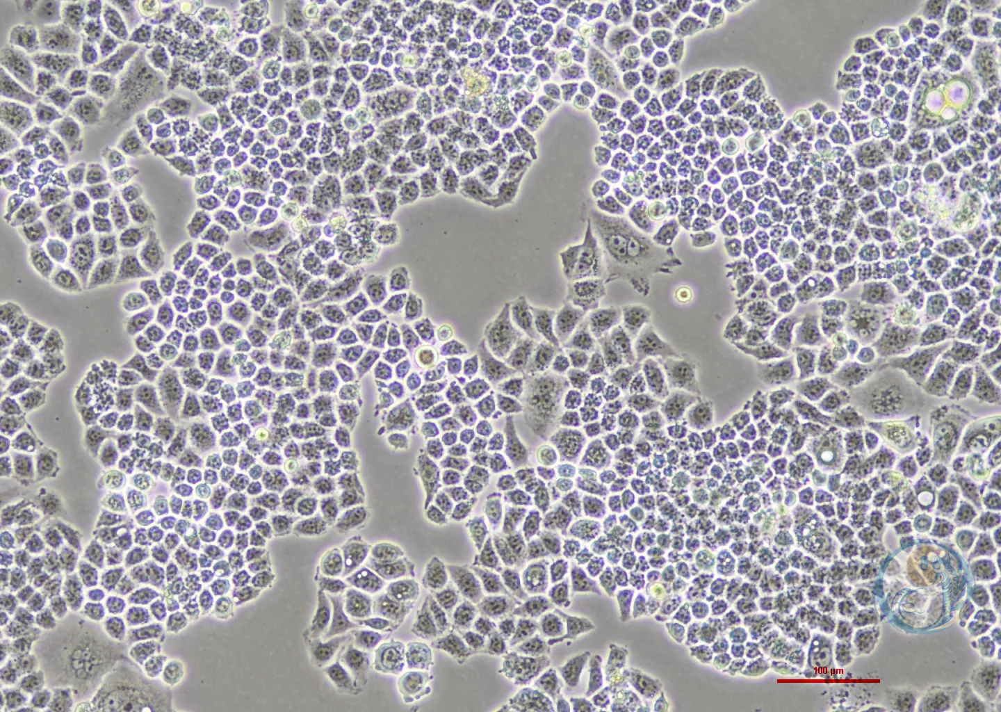 人宫颈癌细胞顺铂耐药株 Hela-DDP