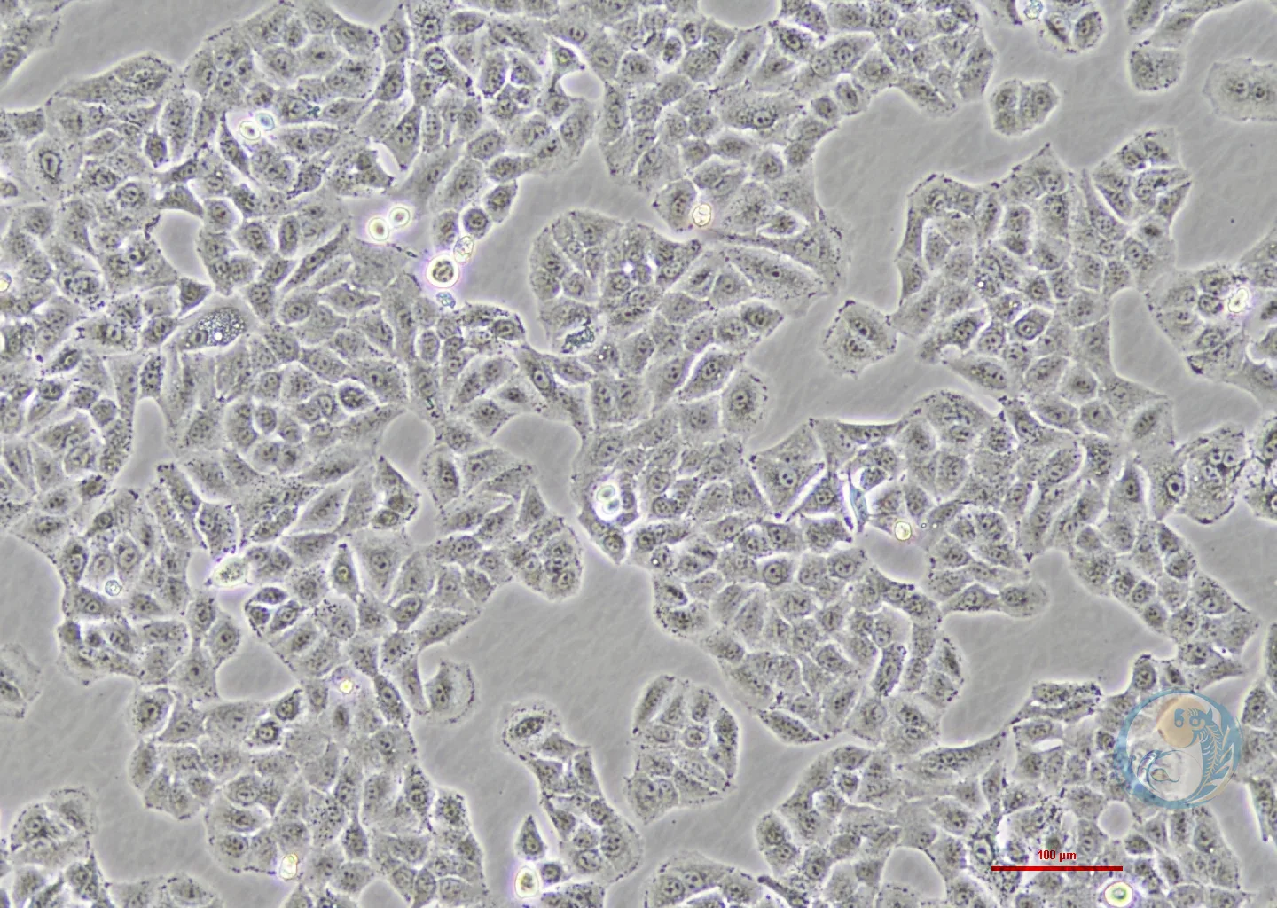 人非小细胞肺癌细胞稳转株 A549-LC3-GFP-RFP