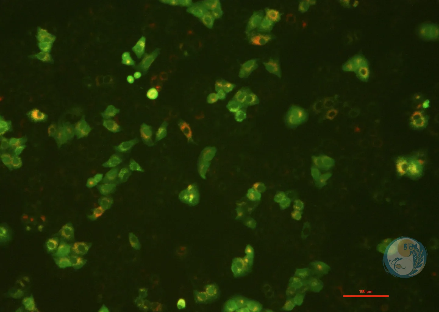 人非小细胞肺癌细胞稳转株 A549-LC3-GFP-RFP 2