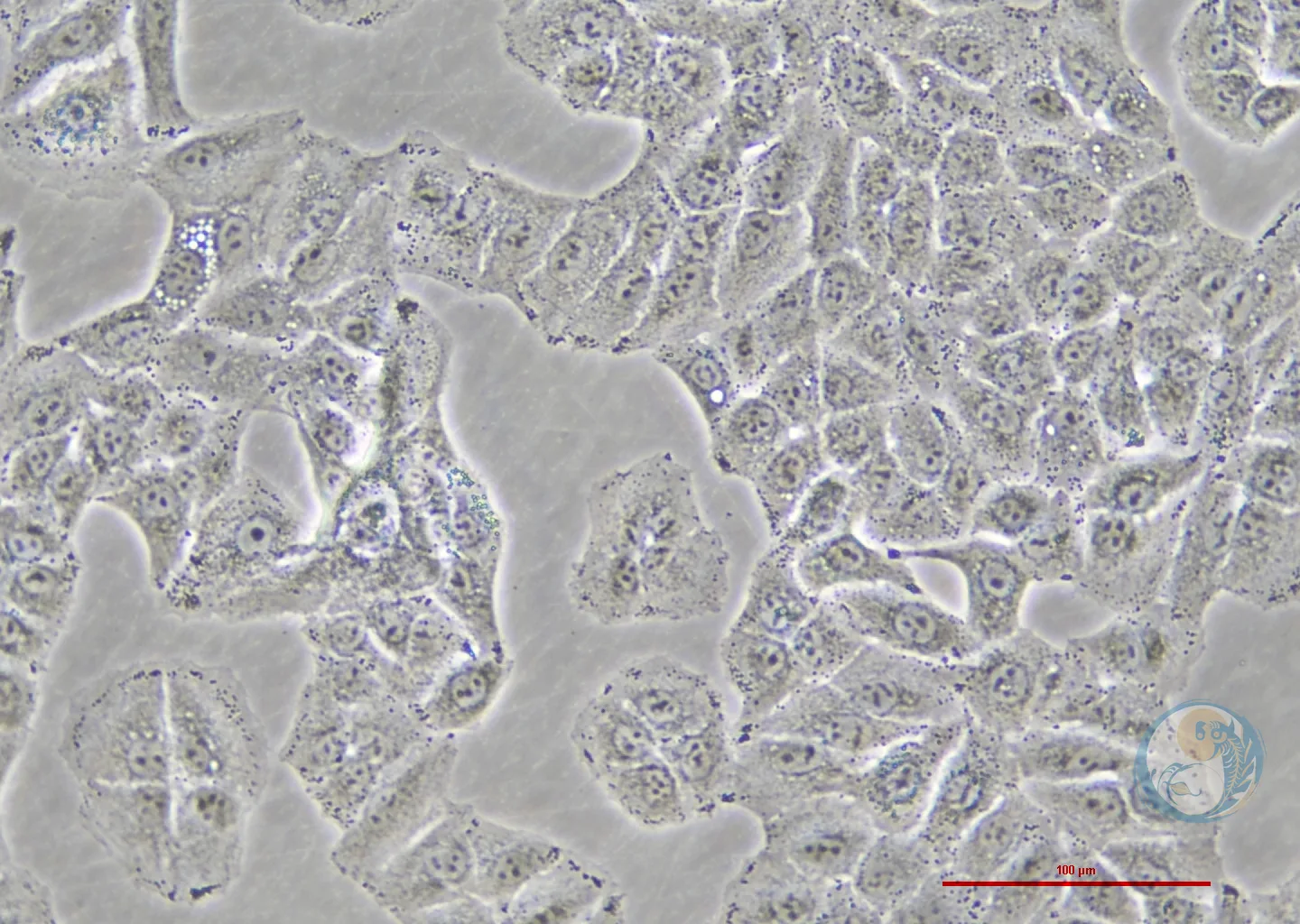 人非小细胞肺癌细胞稳转株 A549-LC3-GFP-RFP 3