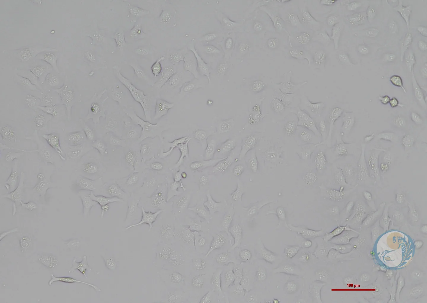 人卵巢癌细胞-绿色荧光标记 Skov3-EGFP 2