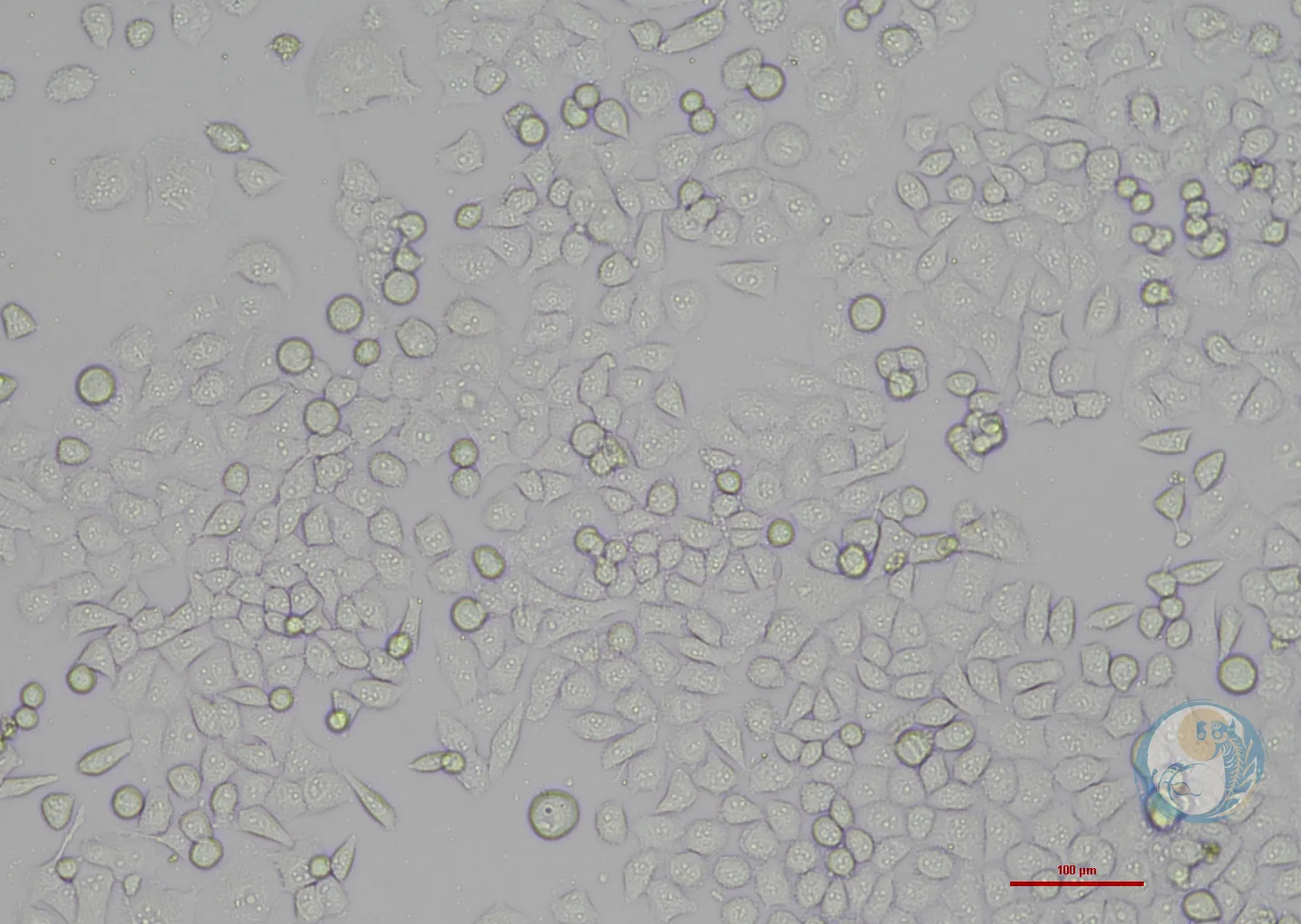人胰腺癌细胞-绿色荧光标记 PANC-1-EGFP 2